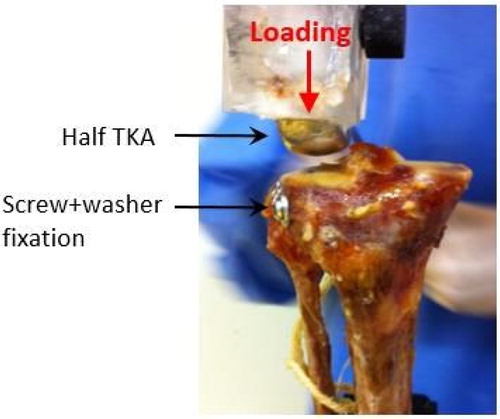 Figure 1. Specimen and specific setup with loading imposed by half Total Knee Arthroplasty (TKA).