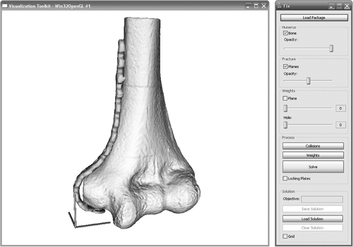 Figure 3. The graphical user interface (GUI) of the system developed for surgical planning. The controls on the right allow the user to load a fracture configuration and generate a solution. Controls are also provided to view the weighting scheme used to generate the solutions.