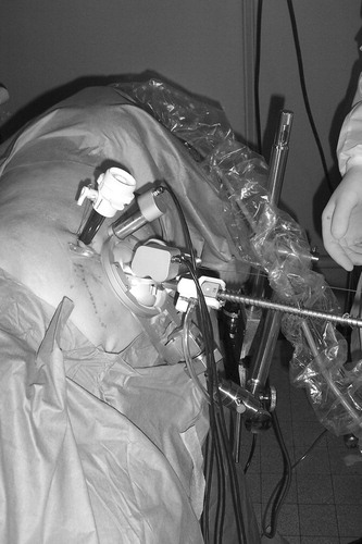 Figure 3. Endoscope manipulator in lateral position.