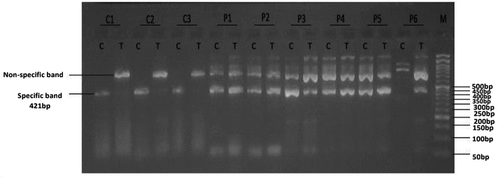 Figure 1. Gel electrophoresis (2%) for PCR product of SOD1 rs1041740. Lane M indicates DNA marker (50 bp). Specific 421 bp band illustrates C or T alleles; Lanes (C1, C2 and C3) represent CC homozygous genotyping, where T allele absents in control group. Lanes (P1, P2, P3, P4 and P5) represent CT heterozygous genotyping; where both C and T alleles were detected at 421 bp in cases group; lane P6 represents TT homozygous genotyping where T allele appears in cases group.