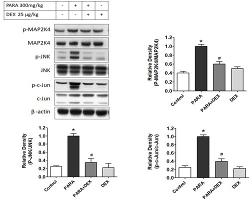 Figure 7 Effects of DEX on hepatic JNK protein expression and activity following PARA-induced liver toxicity. Hepatic p-MAP2K4, MAP2K4, p-JNK, JNK, p-c-Jun, and c-Jun protein expression levels were evaluated in mice administered normal saline (control; lane 1) or PARA (300 mg/kg) alone (PARA; lane 2), or after treatment with DEX (25 μg/kg) 30 mins after injection of PARA (PARA+ DEX; lane 3) or treatment with DEX (25 μg/kg) alone (DEX; lane 4). Blots were reprobed for β-actin to ensure equal protein loading in all lanes. The bands were analyzed using densitometry, and the values are presented as the mean ± SEM; n = 6 mice per group. *p < 0.05 vs. control; #p < 0.05 vs. PARA alone.
