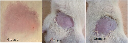 Figure 8. Photographs of skin sections of control group (Group 1), group treated with nanoemulsion F7 (Group 2), and group treated with conventional commercial cream (Lamisil) (Group 3). No signs of edema or erythema were seen (the size of shaved area is approximately 2 × 2 cm2).