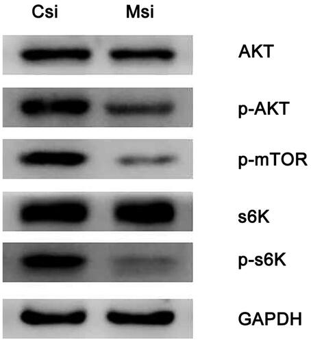 Figure 3. Levels of Akt/mTOR/S6k signal pathway-related proteins in SKOV3 cells after transfection with MFG-E8 siRNA or NC siRNA detected using Western blotting.