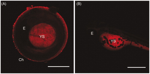 Figure 3. Maximum intensity projections of embryos at 48 hpf (A) and of larvae at 72 hpf (B) exposed to 100 µg/mL of NAs. Exposure time: 100 ms. Scale bar = 500 µm. Ch: chorion; E: Eye; YS: yolk sac.