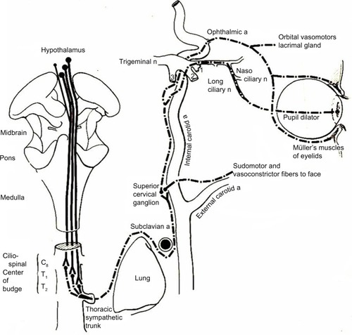 Figure 2 Drawing showing the anatomy of the oculosympathetic pathway.