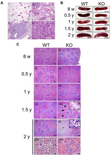Figure 4 Pathological changes in the lungs and spleens of mice with aging. (A) Representative hematoxylin and eosin (HE)-stained images of aged wild-type (WT) and Secretoglobin (Scgb) 3a2-knockout (KO) mouse lungs. (i) Two-year-old WT mouse lungs exhibiting mild lymphocyte aggregation. (ii) Marked lymphocyte aggregation detected in 2-year-old KO mouse lungs. (iii) Atypical lymphocytes observed in 2-y-old KO mouse lung. Scale bars: 200 µm. (iv) Enlarged photo near the asterisk in c. Scale bar: 20 µm. (B) Macroscopic observations and diameters of spleens measured in senescent WT and Scgb3a2-KO mice. Representative spleens are presented. Scale bars: 5 mm. (C) Representative histological observations of spleen tissues from WT (i, iii, v, vii, x, and xiii) and Scgb3a2-KO mice (ii, iv, vi, viii, xi, and xiv) at various ages. In the spleen of 2-year-old KO mice, remarkable fusion of white pulp (xi) and a highly malignant image (ix: inset, ×1000) were observed. Asterisk (*): white pulp fusion; arrowheads: fiber formation; ix: enlargement of arrowheads in viii; xii: enlargement of * in xi; xiii: extramedullary hematopoiesis (erythroid element, megakaryocytes, and myeloid cells) in the splenic red pulp; xiv: erythropoiesis in red pulp. Scale bars: 200 µm (i–viii, x, and xi), 50 µm (xiii, xiv), and 10 µm (ix, xii).