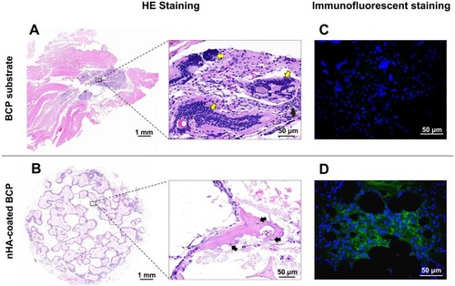 Figure 8 HE histological analysis of in vivo ectopic bone formation ability for BCP (A) and nHA-coated BCP (B) scaffolds after implanted in back muscles of rabbits for 90 days. Yellow arrows: inflammatory cells; black arrows: bone formation as evidenced by osteocytes settled in bone lacuna. Immunofluorescent staining of osteocalcin (OCN) for BCP (C) and nHA-coated BCP (D) groups. Green and blue colors represented osteocalcin and DAPI-stained nuclei, respectively.