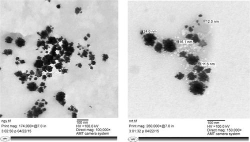 Figure 5 TEM micrograph shows the size of synthesized silver nanoparticles.Abbreviation: TEM, transmission electron microscopy.