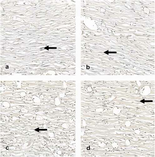 Figure 5. Photomicrography showing the area of elastic fiber (400x). Black arrows indicate elastic fibers stained black by the Verhoeff technique. After 28 days of the experiments, there was a predominance of elastic fibers in the AM group, followed by the SC + AM, SC and control groups.