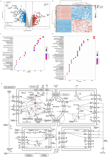 Figure 1 Function enrichment analysis of cholestasis. (A) Volcano map of cholestatic DEGs; (B) Heat map of cholestatic DEGs; (C) GO enrichment of cholestatic DEGs; (D) KEGG enrichment of cholestatic DEGs; (E) Pathway of bile secretion.