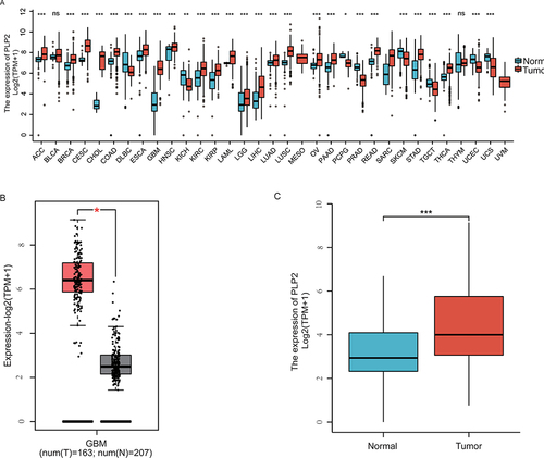 Figure 2 PLP2 expression in cancerous. (A) PLP2 expression in 33 types of human cancer. (B) Expression of PLP2 between GBM and paired normal brain tissues based on the GEPIA2 database. *P < 0.05, **P < 0.01, ***P <. 001, ns (no significance) P>0.05. (C) PLP2 expression was upregulated in GBM using TCGA dataset analysis.