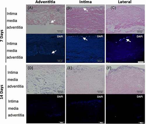 Figure 5. Human umbilical vein endothelial cells (HUVEC) grew and migrated in the decellularized porcine pulmonary artery after implantation via different surfaces. Implantation via the A) adventitia, B) intima, C) lateral after 7 days, and implantation via the D) adventitia, E) intima, F) lateral after 14 days were shown with H&E and DAPI staining. arrows indicated the HUVECs.