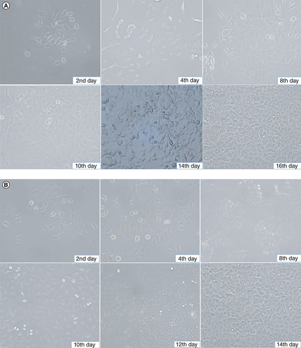 Figure 2. Morphological characteristics of M4 ovarian cancer cells in culture.(A) M4 cancer cells in culture on the second day before washing, there were basal tumor cells and reached 10% on the 4th day. On the eighth day, cells adhered to the bottom 40% of the culture area. On the tenth day, cells adhered to the bottom 60% of the culture area. On the fourteenth day, tumor cells had basal epithelial morphology >80% of the culture area. On the sixteenth day after the first sample separation, the tumor cells had a strong proliferative epithelial morphology, attached to the bottom of more than 90% of the culture area. (B) BALB/c nude mice's secondary tumor cell in culture. The proliferation speed of tumor cells was similar to that of M4 cells isolated from the patient.
