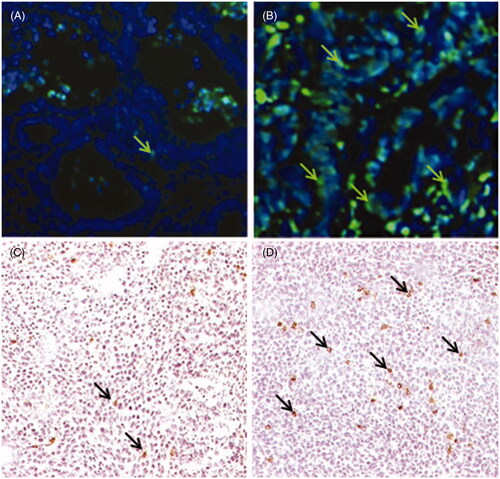 Figure 1. Whole body hyperthermia (WBH) increases the numbers of NK cells and apoptotic cells in colon tumours. (A, B) Localisation of apoptotic cells by TUNEL assay in a patient tumour xenograft from control (A) or WBH treated (B) SCID mice (arrows, original mag. 40X). (C, D) Immunohistochemical localisation of NKp46+ cells in CT26 tumours from control (C) and WBH treated (D) mice at 24 h post-WBH (arrows, original magnification ×10).