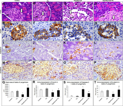 Figure 4 Effect of Thymoquinone on histological structure of the pancreatic islets of Langerhans (A–D) as well as immunoexpression of insulin (E–H), caspase-3 (I–L) and β-catenin (M–P) expression in the pancreas of the studied groups. Haematoxylin and eosin-stained section showed islets (IS) between the pancreatic acini (AC). Islet cells (arrow) appear intact in control, TQ and hypothyroid+TQ groups while they appear degenerated in Hypothyroid group. Note the presence of blood capillaries (thick arrow). Qualitative assessment of the morphometric measurements and immunoexpression (Q–T) was done using image Pro Plus image analysis software version 6.0. *Significantly different compared to the control group (p<0.05). #Significantly different compared to the Hypothyroid group (p<0.05).