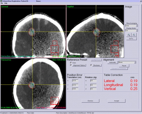Figure 2.  The desktop screen at the time of image registration. After bone registration, the location of the tumor at the isocenter was verified by eye and registered well.