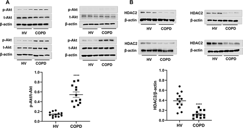 Figure 5 Analysis PI3K/Akt pathway activity and HDAC2 protein levels of PBMCs from Healthy volunteers and patients with COPD.