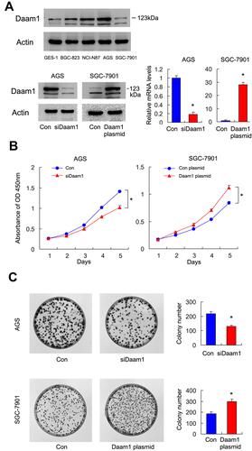 Figure 3 Daam1 positively regulates GC cell proliferation. (A) Western blot showed that Daam1 protein was low in gastric mucosa GES-1 cell line and higher in GC cell lines NCI-N87, AGS, and BGC-823. Transfection and siRNA knockdown efficiencies were confirmed by Western blot and RT-qPCR in SGC-7901 and AGS cell lines, respectively. (B) CCK8 showed that growth rate was increased in SGC-7901 cells with Daam1 overexpression, while the cell growth rate was decreased in AGS cells after Daam1 siRNA knockdown. (C) Colony formation assay demonstrated that colony counts were higher in SGC-7901 cells with Daam1 overexpression. Daam1 knockdown downregulated colony numbers formed by AGS cell line. *p<0.05.