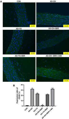 Figure 2 The immunofluorescent analysis of the rat aortic tissues. (A) Immunofluorescence staining of aortic tissue (400×). (B) Rate of CD68 positive expression.