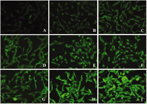 Figure 11. Fluorescence images of bEND.3 cells after incubation with lipid core (A–C), d-rHDL (D–F), and m-d-rHDL (G–I) at 37 °C for 1 h, 2 h, and 4 h, respectively.