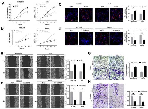 Figure 2 CircARPP21 suppresses cancer progression in HCC cell lines. (A) The growth of HCC cells transfected with si‐circARPP21 was evaluated using the CCK‐8 assay. (B) The growth of HCC cells transfected with the circARPP21 vector was evaluated using the CCK‐8 assay. (C) EdU assays of HCC cells transfected with circARPP21 siRNAs compared to control. (D) EdU assays of HCC cells transfected with circARPP21 vector or control. (E) Wound healing assay performed in cells transfected with circARPP21 siRNAs or control. (F) Wound healing assay performed in cells transfected with circARPP21 vector or control. (G) Cell invasion assays in cells transfected with si-circARPP21 or control. (H) Cell invasion assays in cells transfected with circARPP21 vector or control. Values are shown as the mean ±SD of three independent experiments. *p < 0.05, **p < 0.01, ***p < 0.001.