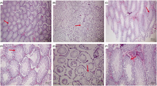 Figure 1. Pathological changes in the testis. Blank control group (A ×40, D ×100): the convoluted tubules in the testis appeared to have a normal structure and ordered arrangement, there were abundant sperm cells. GTW model group (B ×40, E ×100): there were few mature sperms in the lumen and significantly increased numbers of sperm cells with an abnormal morphology. Zuogui Wan group (C ×40, F ×100): The lumen of the seminiferous tubules was obviously enlarged and there were significantly more sperm cells in the lumen.
