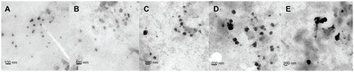 Figure 1 TEM micrograph of DMAB-modified PLGA nanoparticles with different average sizes: (A) 50 nm; (B) 100 nm; (C) 150 nm; (D) 200 nm; and (E) 300 nm.Abbreviations: TEM, transmission electron microscopy; DMAB, didodecyl dimethylammonium bromide; PLGA, coumarin-6 loaded poly (lactide-co-glycolide).