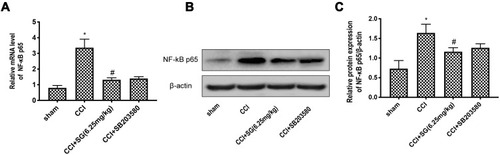 Figure 5 Effect of p38MAPK pathway inhibitor SB203580 on NF-κB in spinal cord of CCI rats. (A) RT-PCR analysis of NF - κ B p65 mRNA levels in the dorsal horn of the spinal cord. (B) Western blot analysis of NF - κ B p65 protein levels in the dorsal horn of the spinal cord. (C) Densitometry analysis of NF - κ B p65 protein levels in the dorsal horn of the spinal cord. Data are shown as mean ± SD, n = 3. Compared with the sham operation group (*P < 0.05), compared with CCI group (#P < 0.05).