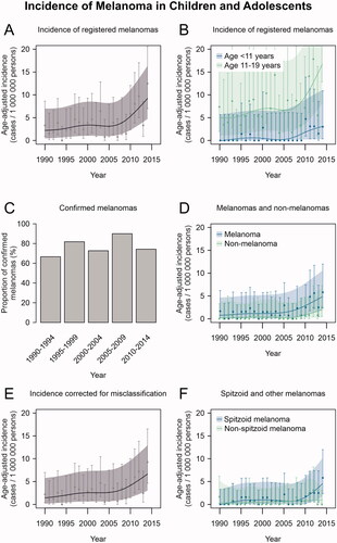 Figure 1. Trends of melanoma incidence in Finland in 1990–2014. (A) Incidence of melanoma cases reported in the Finnish Cancer Registry (FCR). (B) Incidence of melanoma cases reported in the FCR by age group. (C) The proportion of confirmed melanomas out of all the tumours available for re-evaluation in 5-year intervals of diagnosis date. (D) Incidence of confirmed melanomas and non-melanomas among the cases available for re-evaluation (E) Total population incidence of melanoma corrected for misclassification. (F) Incidence of Spitzoid and other melanomas among the cases available for re-evaluation. All incidence estimates have been age-adjusted relative to the Finnish population structure in the year 2014. Age-adjusted point estimates (squares) and their 95% confidence intervals (whiskers) are shown along with estimates and confidence intervals that have been smoothed using cubic splines (continuous lines and shading, respectively).