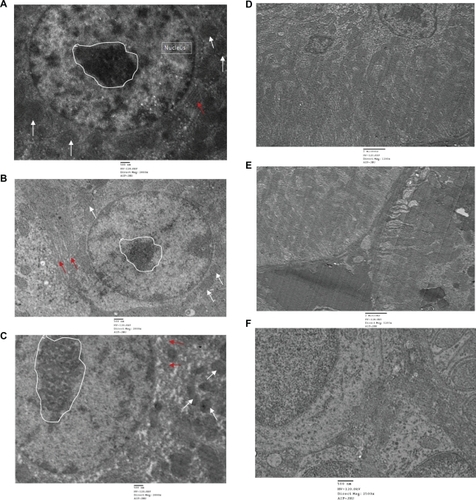 Figure 11 TEM images of liver and kidney of quantum dots (QDs) and anti-HER2ab-QDs treated Wistar rats: A) control (liver), B) animals treated with QDs (liver), C) animals treated with anti-HER2ab-QDs, D) control kidney, E) animals treated with QDs, F) animals treated with anti-HER 2ab-QDs. Single staining was used for all TEM analysis. Random circle in the image show nucleolus, arrow in white color show mitochondria and red arrow indicate RER (rough endoplasmic reticulum).