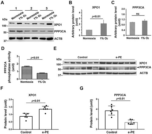 Figure 4. Analysis of XPO1 and PPP3/calcineurin in normoxia/hypoxia-exposed primary human trophoblasts and the placenta from e-PE vs. controls. (A–C) The expression of XPO1 and PPP3 in cells with indicated treatment was evaluated using western blotting in A and statistically analyzed in B and C. (D) The phosphatase activity of PPP3/calcineurin was assessed and compared between hypoxia- and normoxia-treated cells. (E–G) Protein abundance of XPO1 and PPP3 was detected using western blotting (E) and statistically analyzed (F and G) in the placenta from e-PE and gestational age-matched deliveries.