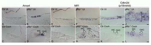 Figure 3 Confirmation of microarray analysis by in situ hybridization. (A–D) Anxa4 was highly upregulated in pRb™/™ utricular (B) and cochlear hair cells (D) compared to controls (A and C). (E–H) In comparison to control (E and G), Mlf1 was upregulated in pRb™/™ utricle (F) and cochlea (H), with more prominent upregulation in cochlear hair cells (IHC, OHC). (I–L) Cdkn2d (p19Ink4d) was significantly upregulated in pRb™/™ cochlear hair cells (L) compared to controls (K). In pRb™/™ utricle, more hair cells expressed Cdkn2a with an expression level similar to the control utricular hair cells (I and J). HC: hair cells; IHC: inner hair cells; OHC: outer hair cells. Scale bar: 20 µm.