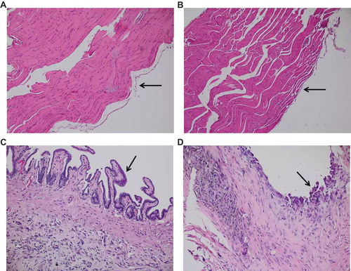 Figure 5. Sustained exposure to palygorskite does not lead to the development of hyperplasia in mice. Diaphragm tissue obtained from Balb/c mice 5 wk after receiving 5 biweekly injections with 0.5 mg of glass (A), palygorskite (B), or crocidolite (C, D) and stained with H&E. Normal mesothelium was observed after glass and palygorskite exposure (A, B, black arrows). Mesothelial hyperplasia observed after exposure to crocidolite (C, D, black arrows). Magnification 200×.