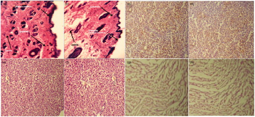 Figure 10. Representative histopathological sections of various organs of mice showing effect of in vivo topical application of 5-FU gel formulation in 28-d dermal toxicity study. (a) Control skin (40×), (b) treated skin, (c) control kidney, (d) treated kidney, (e) control liver, (f) treated liver, (g) control heart and (h) treated heart (10× for all other organs). Tissue sections were stained with hematoxylin and eosin.