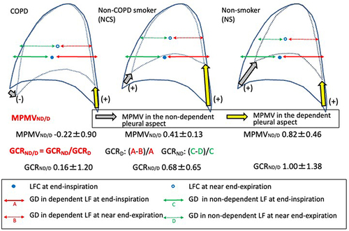 Figure 4 Schematic pleural movements and gravity-oriented parenchymal collapsibility on the median sagittal plane. Schematic overview of differences in pleural movement and gravity-oriented parenchymal collapsibility among the three groups based on our results. MPMVND/D was smallest in patients with COPD, followed by the non-COPD smoker and non-smoker groups. In addition, values of MPMVND/D were negative in some patients with COPD. These results indicate that smoking is associated with a relative decrease in the movement of the non-dependent pleural aspect, and air-flow limitation can result in its paradoxical movement. In accordance with this phenomenon, parenchymal collapse during expiration in the gravitational direction for the non-dependent lung field can be impaired in patients with COPD.