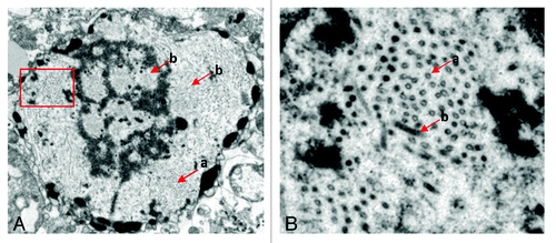 Figure 5. The particles of pHAV-4Ang IIs observed using an electron microscope. The red (a) arrows indicate the particles of pHAV-4Ang IIs. The red (b) arrows indicate the recombinant baculovirus. (A) The particles in whole infected sf9 cells observed (×2,000 zoom in). (B) Large amounts of pHAV-4Ang IIs particles observed in the cytoplasm, which amplified from the rectangle delineation in (A)(×5,000 zoom in).