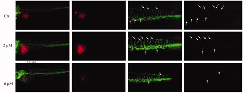 Figure 7. Inhibitory effects of 29e on the proliferation and metastasis of K562 cells in zebrafish xenograft models. CMTPX labelled K562 cells (red) were microinjected into zebrafish embryos, and indicated concentration of 29e were added. White solid arrows indicate disseminated cells.