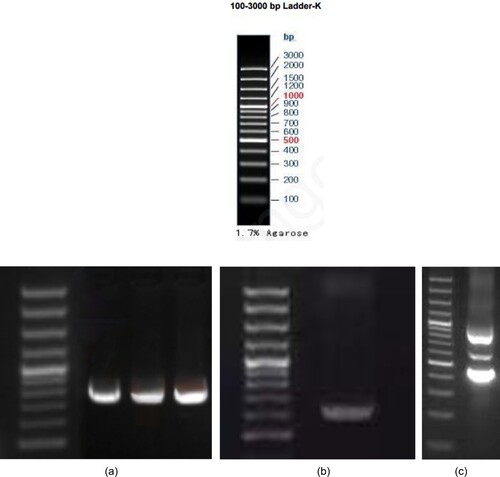 Figure 4. GAP-PCR results of Proband 1 and its family lineage: I. DNA Marker. II.a. From left to right, the second exon PCR results for Proband 1, Proband 1's father, and Proband's sibling. b. Proband 1’s mother exon 3 PCR results. c. Proband 1 exon 3 PCR results. Because Proband 1 is a double heterozygous mutation, the bar has multiple bars.