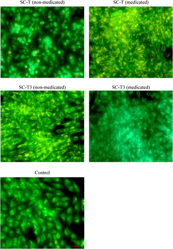 Figure 7. The mode of cell death using acridine orange/ethidium bromide stain on MG-63 cells. The photos show increase in cellular density for all tested samples in comparison to the control cells. (Magnification 20X, Scale bar 50 µm).