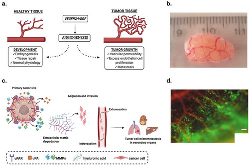 Figure 2. (a) Angiogenesis is regulated by VEGFR/VEGF in both healthy and tumor tissue. But unlike normal blood vessels, tumor vascular networks are chaotic and show an irregular architecture that permits tumor metastasis. (b) Suit2.28 wild-type pancreatic tumor harvested 11 days after grafting, surrounded by rich vascularization (unpublished data). (c) Overview of invasion and metastasis processes. An elevated expression of uPA/uPAR in concomitant with MMPs activity allow the degradation of the ECM and the migration of tumor cells from the primary tumor site by generating micrometastasis foci in distal regions. (d) High disseminating fibrosarcoma cells (HT-hi/diss) demonstrate vasculotropic behavior, in which the cells (green) move away from the primary tumor site and toward the nearby blood vessels (red); scale bar = 50 μm. Reproduced with permission from Deryugina and Kiosses [Citation81]. Copyright 2017 by the authors