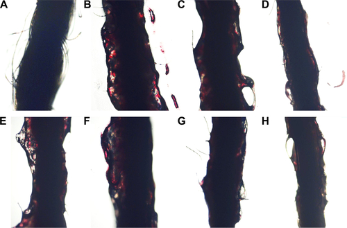 Figure S4 The morphology of the arterial thrombus in rat model.Notes: (A) Thread without thrombus; (B) thread with thrombus from the rat treated with NS; (C) thread with thrombus from the rat treated with 16.7 μmol/kg aspirin; (D) thread with thrombus from the rat treated with 167 μmol/kg aspirin; (E) thread with thrombus from the rat treated with 100 nmol/kg TAVV; (F) thread with thrombus from the rat treated with 10 nmol/kg IQCA-TAVV; (G) thread with thrombus from the rat treated with 1 nmol/kg IQCA-TAVV; (H) Thread with thrombus from the rat treated with 0.1 nmol/kg IQCA-TAVV.Abbreviations: IQCA-TAVV, N-(3S-1,2,3,4-tetrahydroisoquinoline-3-carbonyl)-Thr-Ala-Arg- Gly-Asp(Val)-Val; NS, normal saline.