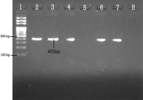 Figure 4 Agarose gel electrophoresis (1.5%) used for separation of PCR products. Lane 2, positive control; Lane 3, 4, 6 and 7 are Dham positive; Lane 5, Dham negative; and Lane 8, negative control.