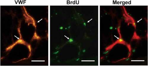 Figure 5. The angiogenic differentiation of Bcl-2-modified adipose-derived stem cells 3 weeks after transplantation. The vWF-positive vascular structure was red. The BrdU-positive Bcl-2-modified adipose-derived stem cells were green. In merged image of the vWF-positive vascular structure with the BrdU-positive Bcl-2-modified adipose-derived stem cells, arrows indicate the location of BrdU-positive and vWF-positive cells. Double immunofluorescence staining revealed Bcl-2-modified adipose-derived stem cells incorporated into the endothelial lining of neocapillary. Scale bars = 20 µm.