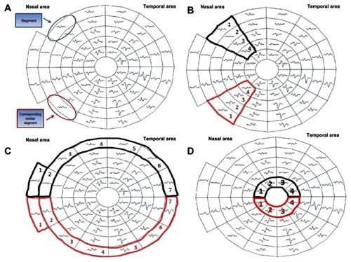 Figure 1 The 58 segments of the right visual field. The field is divided into two identical hemifields across the horizontal meridian; each segment has a similar correspondent in the opposite hemifield (A) the SNR value is calculated in each segment. The average SNR of the wedge sectors (B) and semi-circular sector; peripheral and central (C and D) are calculated to compare to the fellow corresponding sector on the opposite hemifield.