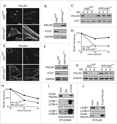 Figure 8. PDLIM1 accumulates in autophagy-deficient Sertoli cells and can be degraded through the autophagy pathway. (A) PDLIM1 was accumulated in AMH-atg5−/− Sertoli cells. Immunofluorescent analysis using PDLIM1 in Atg5Flox/Flox(upper panels) and AMH-atg5−/− (lower panels) Sertoli cells. (B) The PDLIM1 protein level increased in AMH-atg5−/− Sertoli cells. Immunoblotting analysis of PDLIM1 and ATG5 was performed in both Atg5Flox/Flox and AMH-atg5−/−Sertoli cells. GAPDH served as a loading control. (C) ATG5 was crucial for the degradation of PDLIM1. A cycloheximide chase (CHX) assay of PDLIM1 was performed in Atg5Flox/Flox and AMH-atg5−/−Sertoli cells. Samples were taken at 0, 2, and 6 h after the addition of CHX for 2 h. The PDLIM1 protein level was detected by immunoblotting, and VCP/p97 served as a loading control. (D) Quantification of the relative PDLIM1 levels in (C). The amounts of PDLIM1 were quantified using the Odyssey software. (E-H) PDLIM1 is accumulated in AMH-atg7−/− Sertoli cells, and ATG7 was crucial for the degradation of PDLIM1. Similar immunofluorescence (E) and immunoblotting (F) analysis of PDLIM1 was performed in Atg7Flox/Flox and AMH-atg7−/−Sertoli cells. PDLIM1 was measured and detected as in (G). GAPDH served as a loading control. The relative PDLIM1 levels were quantified as in (H). (I and J) PDLIM1 interacts with LC3B. pRK-FLAG-Pdlim1 was transfected into HEK293T cells. Twenty-four h after transfection, cells were collected for immunoprecipitation (IP) with anti-LC3A/B (I) or anti-FLAG (J) and analyzed with FLAG or LC3B antibodies, respectively. See also Figure S7 and S8.