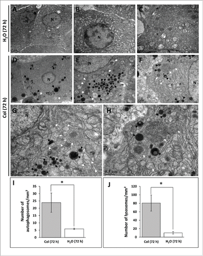 Figure 2. Electron microscopy (EM) analysis of liver sections of trout. The trout were treated for 72 h with water (A to C) or 0.8 mg/kg/d colchicine (D to H). N, nucleus; white arrow, autophagic vacuole; black arrow, lysosome. Graphs: average number of autophagosomes (I) and lysosomes (J) per mm2 in the EM images. (*, P < 0.05; n = 3 samples with 8 to 10 micrographs per sample).