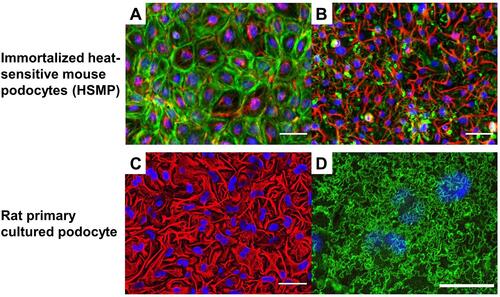 Figure 7 Interdigitating the foot process formation with cultured podocytes (A and B) Induction of the process formation with heat-sensitive mouse podocytes (HSMP), vimentin (red), F-actin (green), and 4′,6-diamidino-2-phenylindole (DAPI) (blue); scale bar 100 µm. (A) The disseminated pattern of vimentin and stress fiber pattern of F-actin are observed in HSMP cultured with the standard media with 10% FBS. (B) Induced highly arborized patterns stemming from the nucleus of vimentin and the absence of F-actin stress fiber are evident in HSMP. (C and D) Interdigitating process formation with the rat primary podocyte and linear pattern of nephrin localization, vimentin (red), nephrin (green), and DAPI (blue); scale bar 100 µm. (C) Interdigitating cell processes were observed. (D) Nephrin staining showed the linear pattern between the cell-cell junctions under the same culture condition of (C).