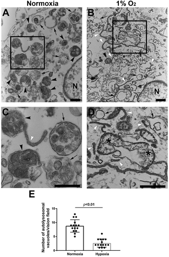Figure 5. Ultrastructural analysis of autophagic vacuoles in primary human trophoblasts treated with hypoxia or normoxia. (A, B) Micrographs show autophagosomes (arrows), autolysosomes (black arrowheads) and isolation membranes or phagophores (white arrowheads) in normoxia- (A) and hypoxia- (B) treated cells. (C, D) Boxed areas in A and B were magnified in C and D, respectively, to show details of autophagic vacuoles. (E) Semi quantification was performed to evaluate the number of autolysosomes in normoxia- and hypoxia-treated trophoblasts. Bar: 600 nm.