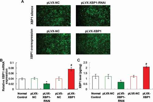 Figure 2. Determination for the pLVX-XBP1 and pLVX-XBP1-RNAi transfection in the adipocytes using fluorescence assay, qRT-PCR and ELISA. (a). Fluorescence assay for determining transfection of pLVX-XBP1 and pLVX-XBP1-RNAi transfection. (b). qRT-PCR assay for determining expressive efficacy of pLVX-XBP1 and pLVX-XBP1-RNAi. (c). ELISA for determining expressive efficacy of pLVX-XBP1 and pLVX-XBP1-RNAi. * p < 0.05 vs. pLVX-NC group, # p < 0.05 vs. pLVX-XBP1 group