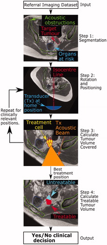 Figure 1. Schematic of proposed patient workflow. Workflow designed to assess the potentially MRgHIFU-treatable percentage of a patient’s target tumor. Using a supine referral image dataset, step 1 involves segmentation of important structures: organs at risk, acoustic obstructions, and the target tumor. Step 2 rotates the referral imaging dataset into possible treatment positions, with the tumor centroid lying, by idealized design, along a vertical line through the magnetic isocentre and, by system design, the transducer’s home position. In step 3, target coverage (i.e. percentage of target volume coverable by an 8 mm treatment cell) is calculated. Cycling through steps 2 & 3 identifies the patient orientation with the maximum target volume coverage. In step 4, the treatable percentage of the target volume is quantified, using acoustic and thermal modeling of MRgHIFU treatment. This allows a clinical decision of whether to progress to treatment to be made.